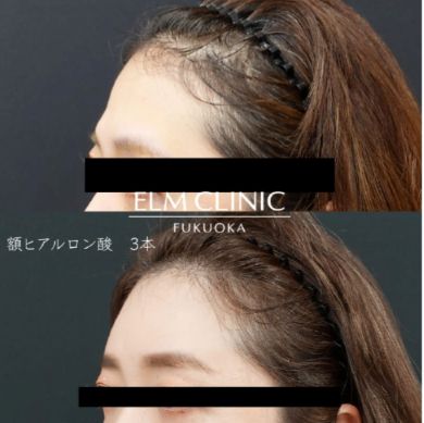 エルムクリニックの症例1